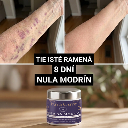 💜 100 000+ predaných kusov 💁‍♀️ – PuraCure® Regeneračný krém na modriny a spevnenie pokožky